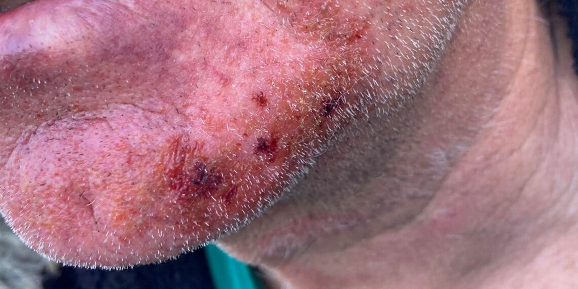 Slachtoffer woningoverval: “Hij drukte zijn hand in mijn gezicht zodat ik niet kon ademen”