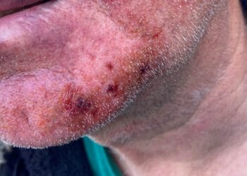 Slachtoffer woningoverval: “Hij drukte zijn hand in mijn gezicht zodat ik niet kon ademen”